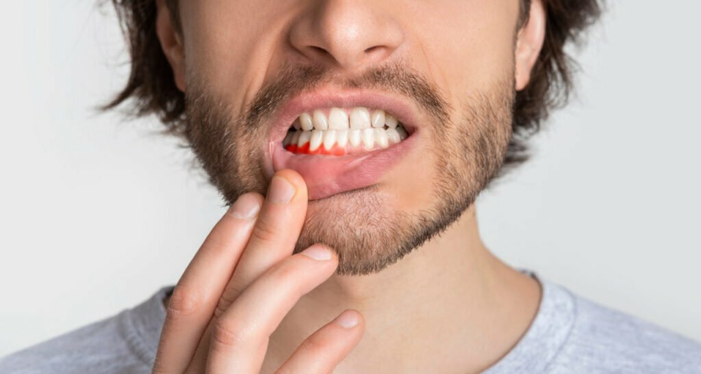 tandvlees diabetes